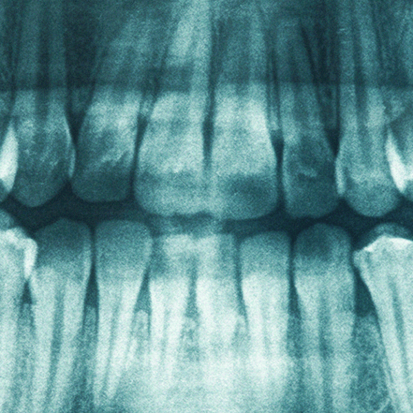 Toothless: Despite fraud, law lets dentists keep licenses